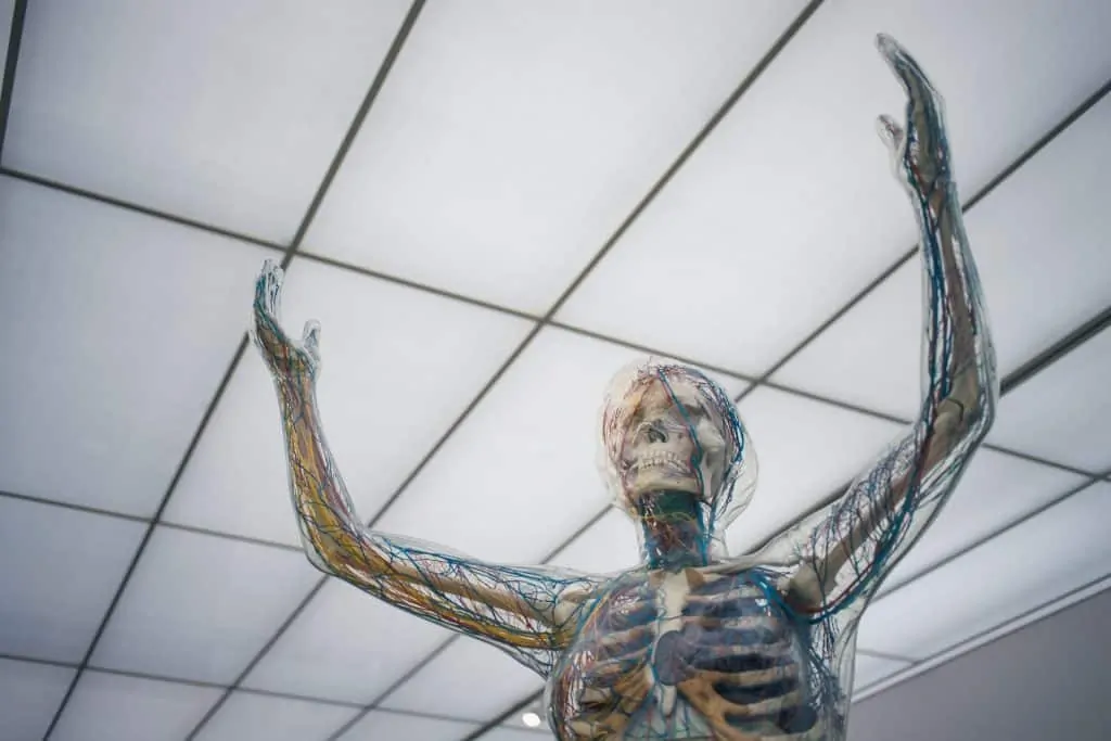photo of a sculpture showing the central nervous system of the body; what is MS or multiple sclerosis??