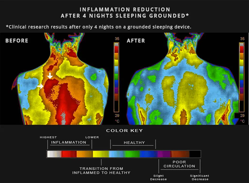 diagram showing inflammation reduction in a man after sleeping in a grounded bed for 4 nights; origins of earthing.