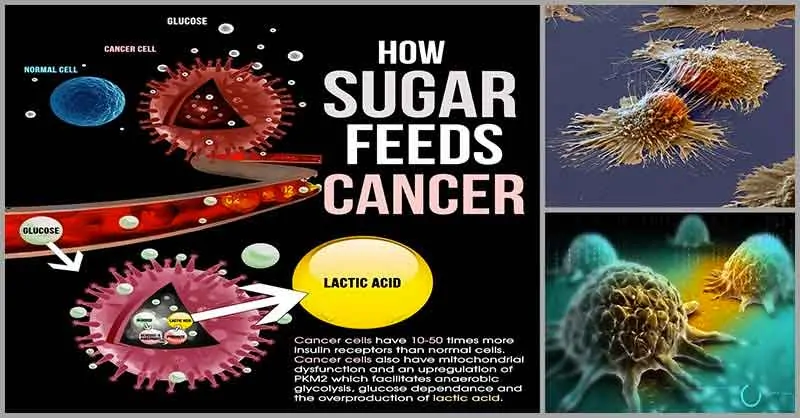 diagram shoing how sugar feeds cancer.