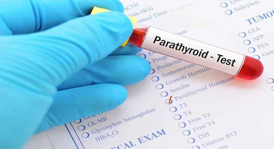 photo of a hand in a surgical glove holsing a test tube that says parathyroid